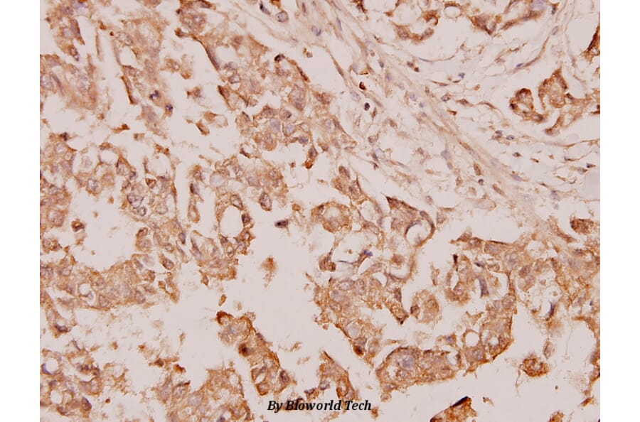 Anti-TGF β3 (G292) Antibody from Bioworld Technology (BS1363) - Antibodies.com