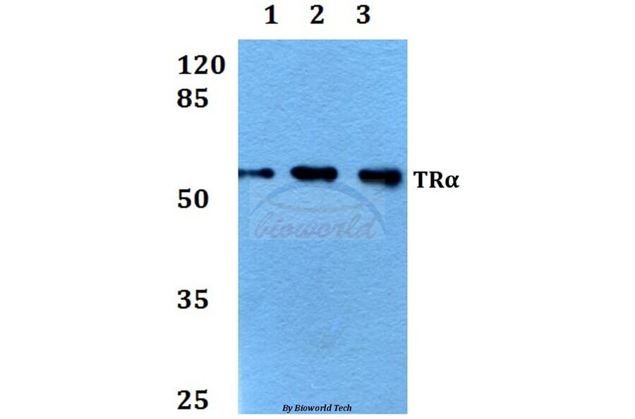 Anti-TRα (A19) Antibody from Bioworld Technology (BS1364) - Antibodies.com