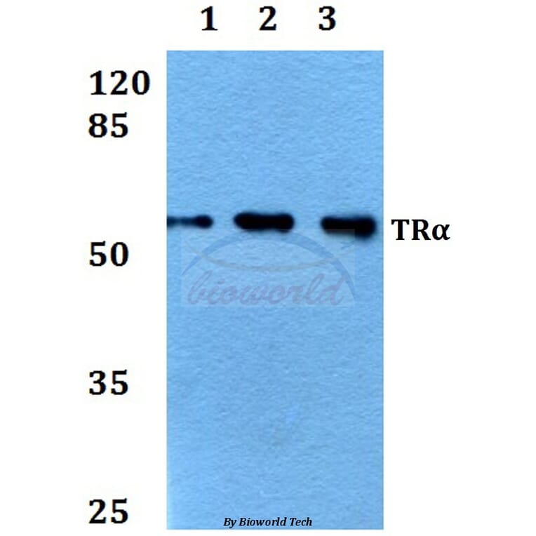 Anti-TRα (A19) Antibody from Bioworld Technology (BS1364) - Antibodies.com