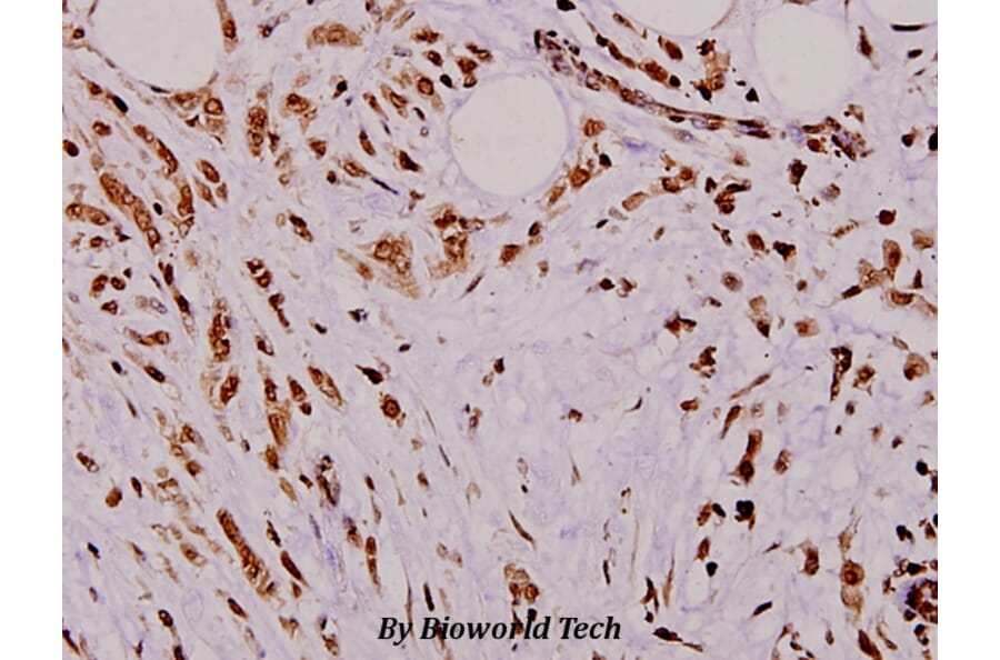 Anti-TRα (A19) Antibody from Bioworld Technology (BS1364) - Antibodies.com
