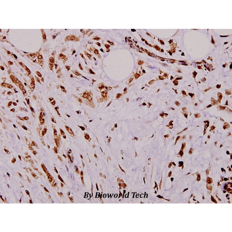 Anti-TRα (A19) Antibody from Bioworld Technology (BS1364) - Antibodies.com