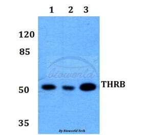 Anti-THRB (L37) Antibody from Bioworld Technology (BS1365) - Antibodies.com