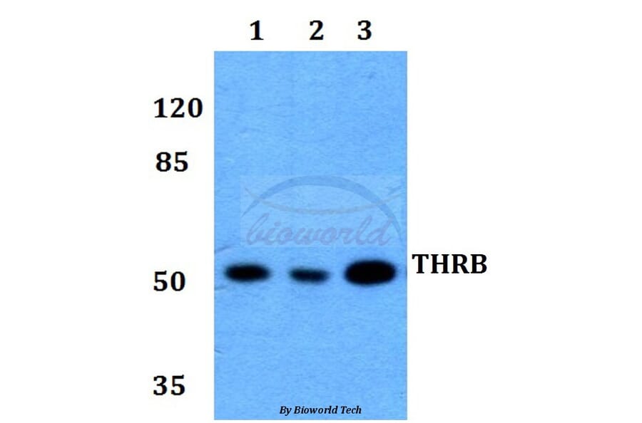 Anti-THRB (L37) Antibody from Bioworld Technology (BS1365) - Antibodies.com