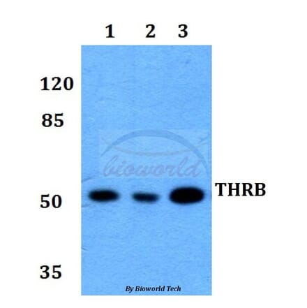 Anti-THRB (L37) Antibody from Bioworld Technology (BS1365) - Antibodies.com