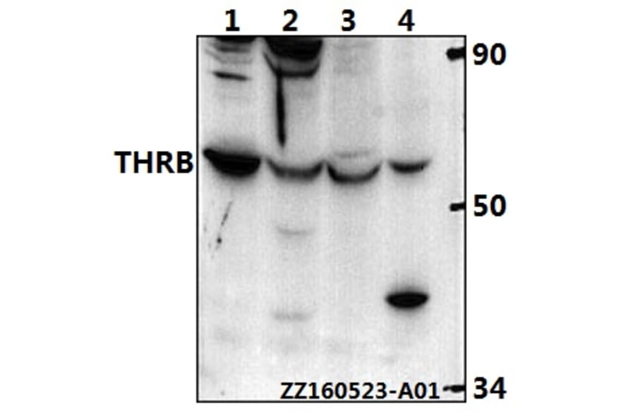 Anti-THRB (L37) Antibody from Bioworld Technology (BS1365) - Antibodies.com