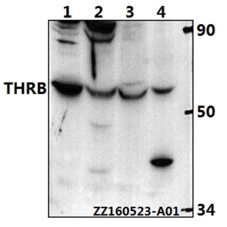Anti-THRB (L37) Antibody from Bioworld Technology (BS1365) - Antibodies.com