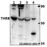 Anti-THRB (L37) Antibody from Bioworld Technology (BS1365) - Antibodies.com