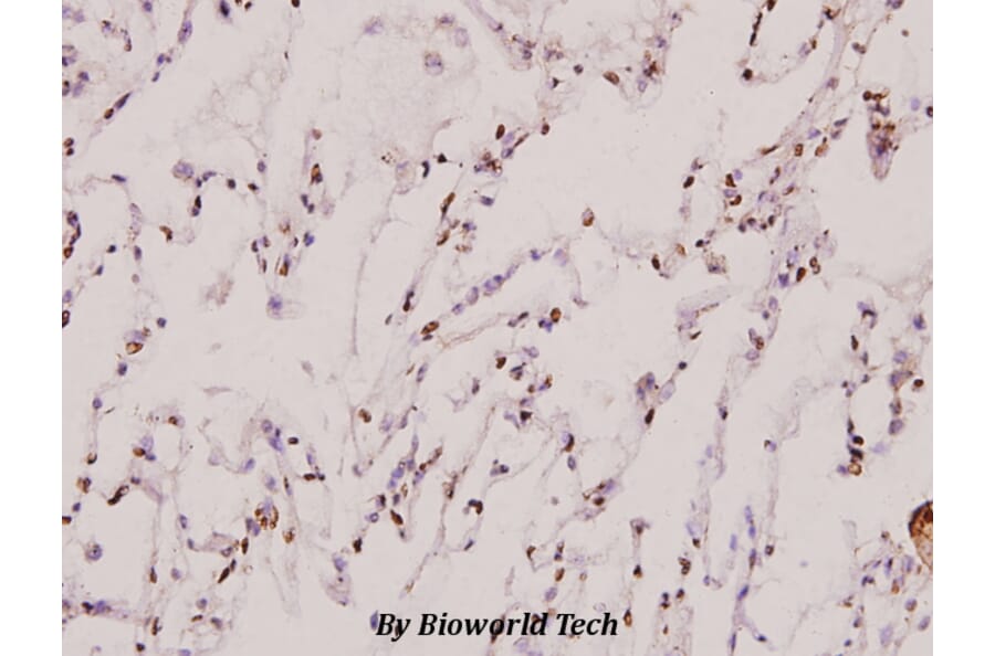 Anti-THRB (L37) Antibody from Bioworld Technology (BS1365) - Antibodies.com