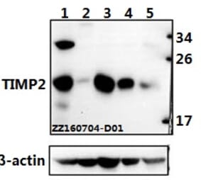 Anti-TIMP-2 (A47) Antibody from Bioworld Technology (BS1366) - Antibodies.com