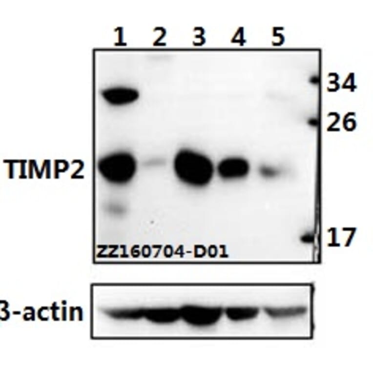 Anti-TIMP-2 (A47) Antibody from Bioworld Technology (BS1366) - Antibodies.com