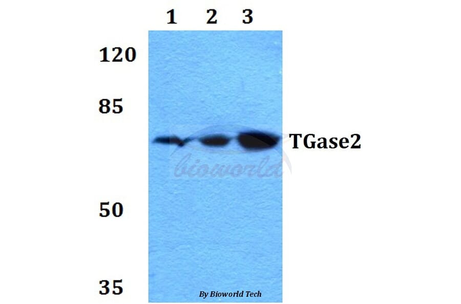 Anti-TGase2 (D11) Antibody from Bioworld Technology (BS1367) - Antibodies.com