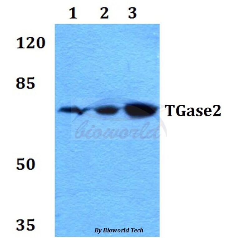 Anti-TGase2 (D11) Antibody from Bioworld Technology (BS1367) - Antibodies.com