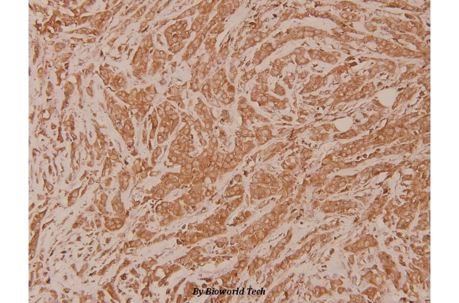 Anti-TGase2 (D11) Antibody from Bioworld Technology (BS1367) - Antibodies.com