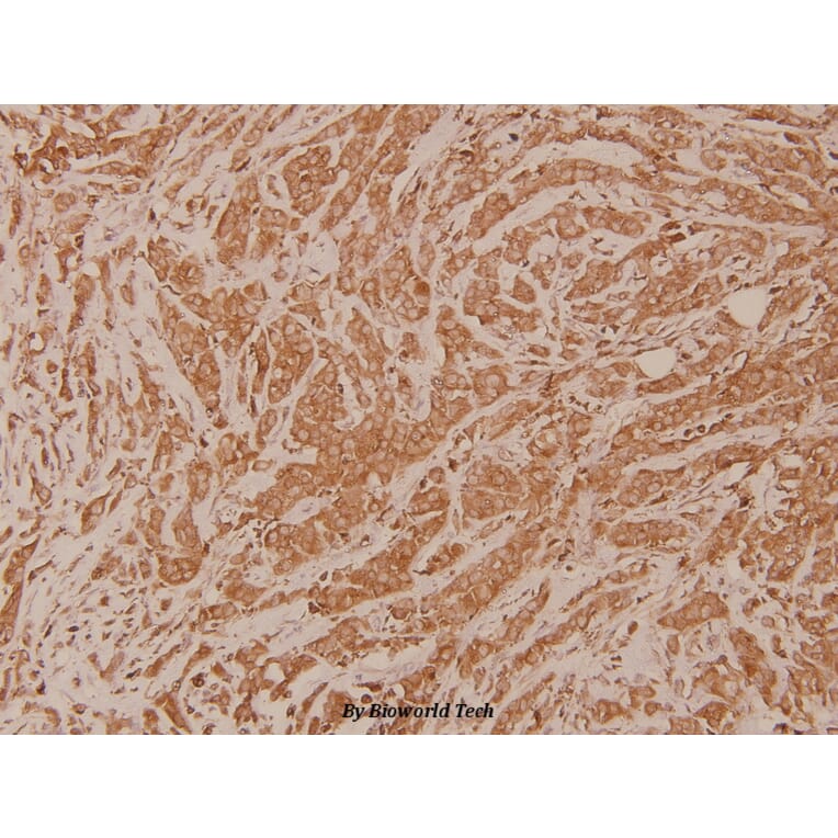 Anti-TGase2 (D11) Antibody from Bioworld Technology (BS1367) - Antibodies.com