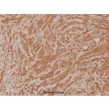 Anti-TGase2 (D11) Antibody from Bioworld Technology (BS1367) - Antibodies.com