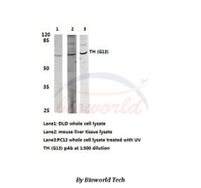 Anti-TH (G13) Antibody from Bioworld Technology (BS1368) - Antibodies.com