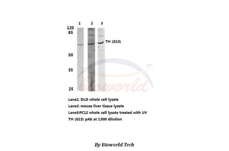 Anti-TH (G13) Antibody from Bioworld Technology (BS1368) - Antibodies.com