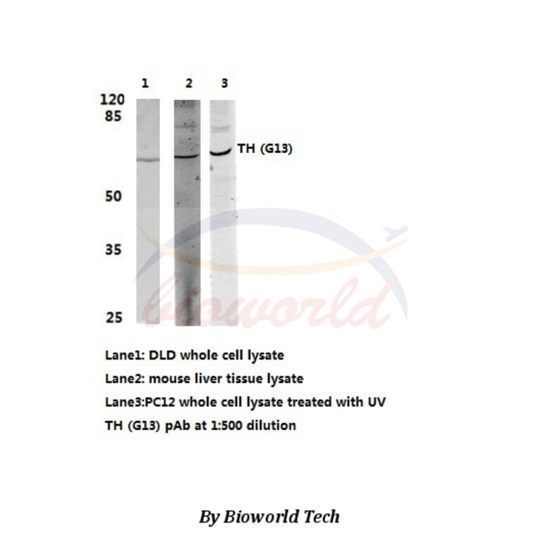 Anti-TH (G13) Antibody from Bioworld Technology (BS1368) - Antibodies.com