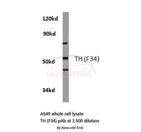 Anti-TH (F34) Antibody from Bioworld Technology (BS1369) - Antibodies.com