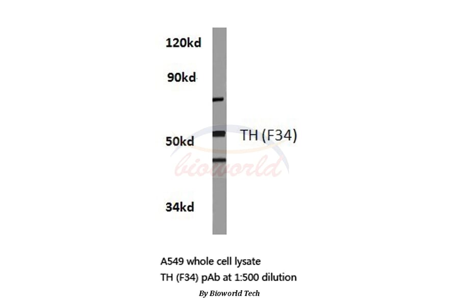 Anti-TH (F34) Antibody from Bioworld Technology (BS1369) - Antibodies.com