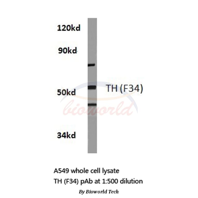 Anti-TH (F34) Antibody from Bioworld Technology (BS1369) - Antibodies.com