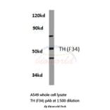 Anti-TH (F34) Antibody from Bioworld Technology (BS1369) - Antibodies.com