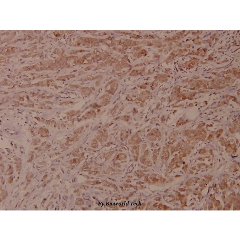 Anti-VaV1 (A168) Antibody from Bioworld Technology (BS1370) - Antibodies.com