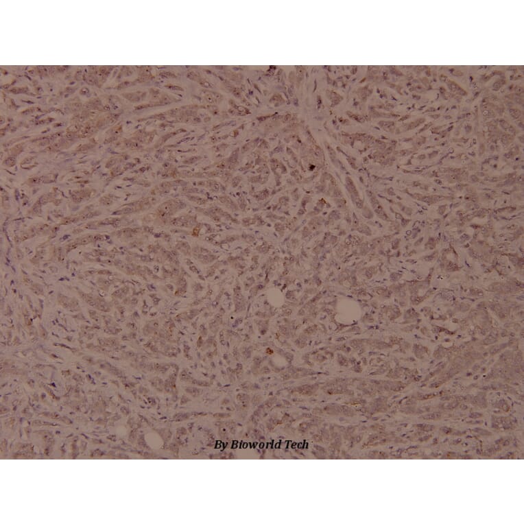 Anti-VEGFR2/Flk-1 (Q1169) Antibody from Bioworld Technology (BS1371) - Antibodies.com