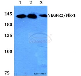 Anti-VEGFR2/Flk-1 (F945) Antibody from Bioworld Technology (BS1373) - Antibodies.com