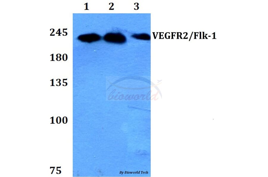 Anti-VEGFR2/Flk-1 (F945) Antibody from Bioworld Technology (BS1373) - Antibodies.com