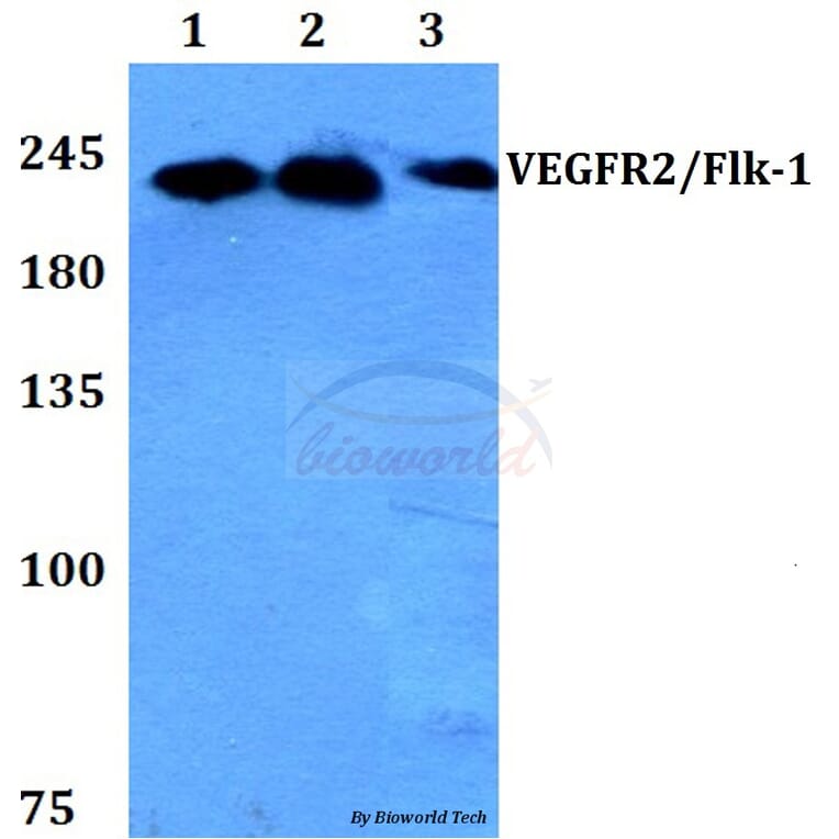 Anti-VEGFR2/Flk-1 (F945) Antibody from Bioworld Technology (BS1373) - Antibodies.com