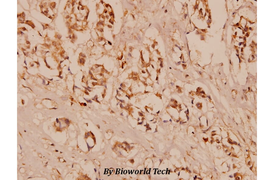 Anti-VEGFR2/Flk-1 (F945) Antibody from Bioworld Technology (BS1373) - Antibodies.com