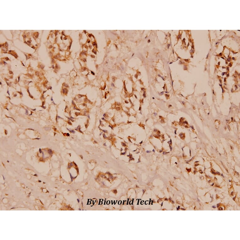 Anti-VEGFR2/Flk-1 (F945) Antibody from Bioworld Technology (BS1373) - Antibodies.com