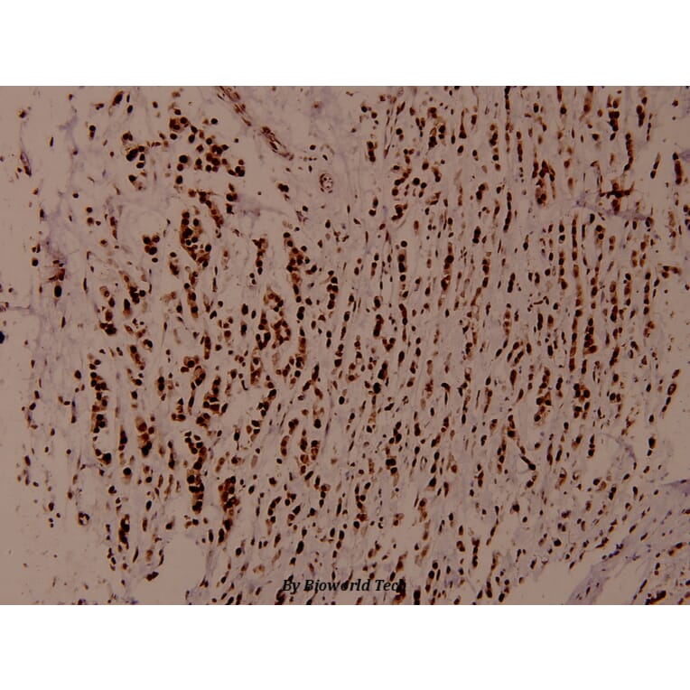 Anti-WNK1 (Y52) Antibody from Bioworld Technology (BS1374) - Antibodies.com