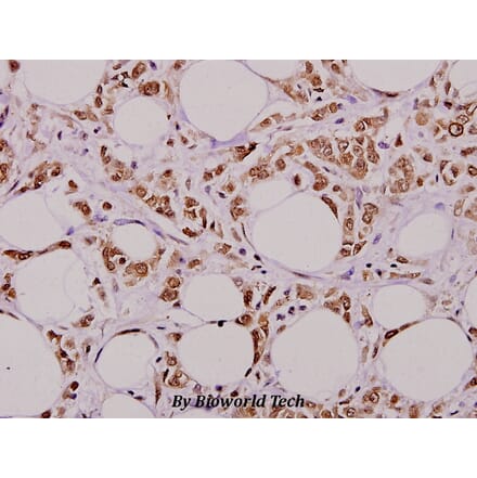 Anti-4E-BP1 (L58) Antibody from Bioworld Technology (BS1375) - Antibodies.com