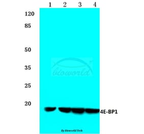 Anti-4E-BP1 (N63) Antibody from Bioworld Technology (BS1376) - Antibodies.com