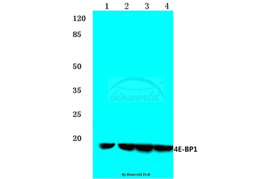 Anti-4E-BP1 (N63) Antibody from Bioworld Technology (BS1376) - Antibodies.com