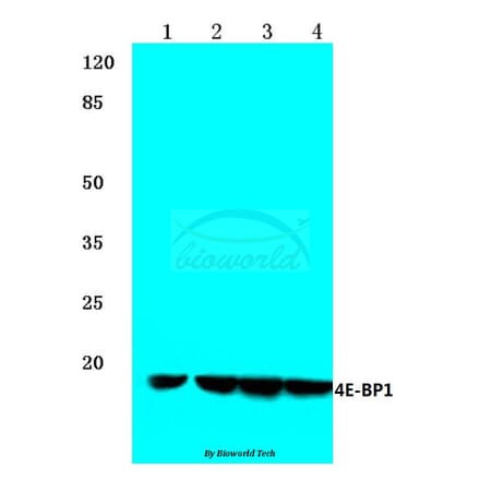 Anti-4E-BP1 (N63) Antibody from Bioworld Technology (BS1376) - Antibodies.com