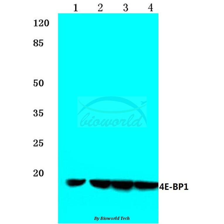 Anti-4E-BP1 (N63) Antibody from Bioworld Technology (BS1376) - Antibodies.com