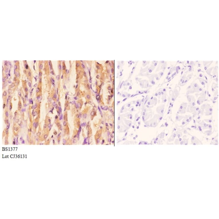 Anti-ACCα (K86) Antibody from Bioworld Technology (BS1377) - Antibodies.com