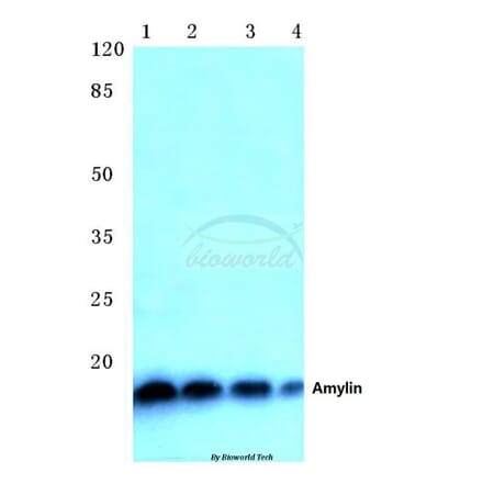 Anti-Amylin (H28) Antibody from Bioworld Technology (BS1381) - Antibodies.com