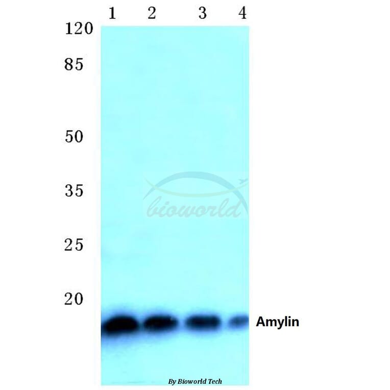 Anti-Amylin (H28) Antibody from Bioworld Technology (BS1381) - Antibodies.com