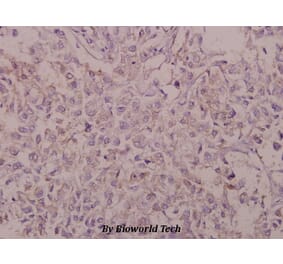 Anti-BACE (D492) Antibody from Bioworld Technology (BS1382) - Antibodies.com