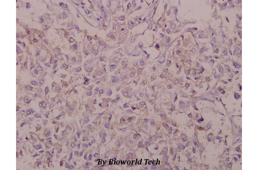 Anti-BACE (D492) Antibody from Bioworld Technology (BS1382) - Antibodies.com