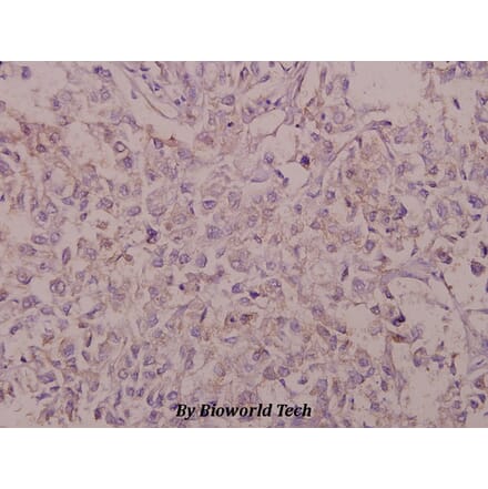 Anti-BACE (D492) Antibody from Bioworld Technology (BS1382) - Antibodies.com