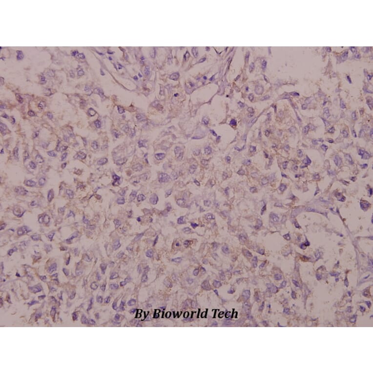 Anti-BACE (D492) Antibody from Bioworld Technology (BS1382) - Antibodies.com