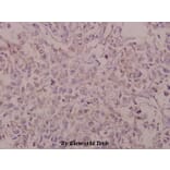 Anti-BACE (D492) Antibody from Bioworld Technology (BS1382) - Antibodies.com