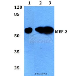 Anti-MEF-2 (I402) Antibody from Bioworld Technology (BS1383) - Antibodies.com