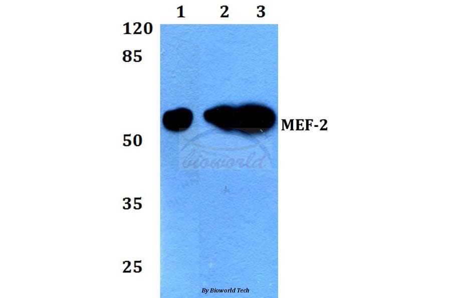 Anti-MEF-2 (I402) Antibody from Bioworld Technology (BS1383) - Antibodies.com