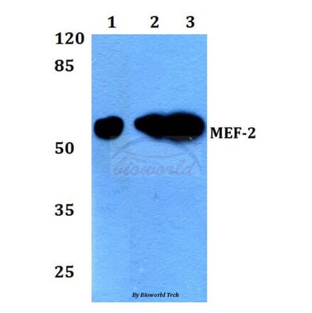 Anti-MEF-2 (I402) Antibody from Bioworld Technology (BS1383) - Antibodies.com